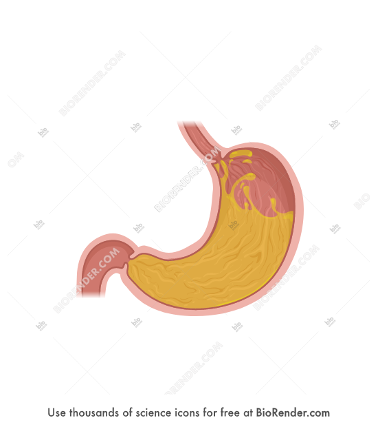 gastric juices gastric juices